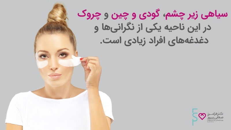 تزریق ژل به زیر چشم